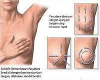 pengobatan penyakit kelenjar payudara